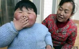Cuộc sống của cô bé 2 tuổi khổng lồ