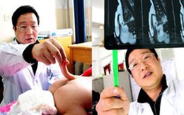 Bé gái "mọc" đuôi dài 12cm