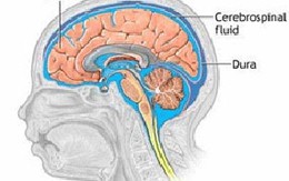 Phát hiện nguồn gốc mới gây bệnh viêm màng não