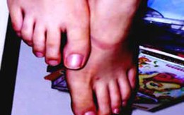 Một người chết vì vô tình... giẫm chân nhau