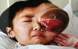 Em bé có đôi mắt khổng lồ