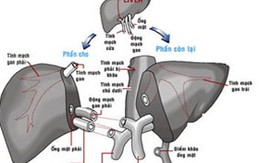 Cấy ghép gan sống nhờ lấy tế bào gốc trong tủy 