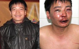 Không khởi tố vụ hành hung nhà báo Trần Thế Dũng