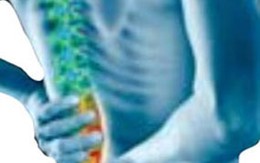 Đừng để cột sống mọc… gai