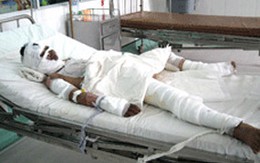 Bé gái 13 tuổi bị đốt cháy quyết sống để vạch mặt thủ phạm