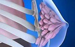 Những bài thuốc chữa viêm tuyến sữa