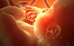 Cứu thai nhi trong bụng người mẹ đã chết vì H1N1