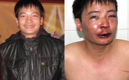 Viện KSND tối cao yêu cầu kiểm tra vụ hành hung nhà báo