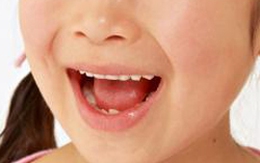 Nói giỏi ngoại ngữ sau khi bị hôn mê