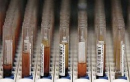 Xu hướng tìm người yêu theo nhóm máu