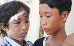 Ký ức tuổi thơ đau buồn của cậu bé bị hành hạ như thời trung cổ
