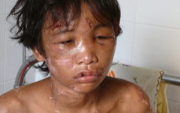 Chủ trại tôm Minh Đức hành hạ cháu Hào Anh suốt 8 tháng    