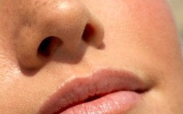 Bị hoại tử mũi vì... bị bạn nhậu cắn