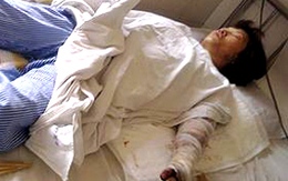 Truy bắt khẩn cấp gã chồng dùng xăng "thiêu sống" vợ