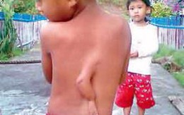Cậu bé "mọc" thêm một cánh tay sau lưng
