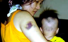 Vợ không chịu ly hôn, chồng vác dao truy sát?