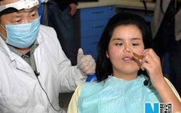 Cô gái 22 tuổi không có xương hàm và răng