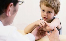 Vì sao dễ bị vết thâm tím trên người?