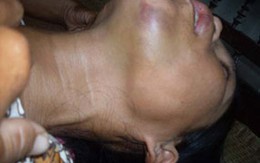 Đấm đá phụ nữ đến ngất vì nghi nhặt vàng không trả 