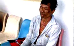 Ghen tuông, "thiêu" vợ bằng 40 lít xăng