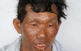 Chân dung kẻ dùng 40 lít xăng biến vợ thành "ngọn đuốc"
