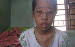 Cô bé suốt 12 năm không thể khép mắt