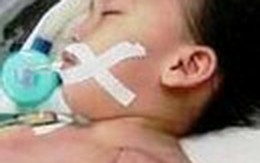 Cắt khối u nặng gần 4kg trên cánh tay bé gái 3 tuổi
