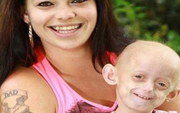 Tâm sự người mẹ có con gái 7 tuổi trong hình hài bà lão
