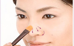 10 cách trị mụn đầu đen vùng mũi 