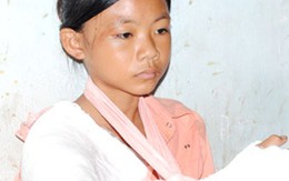 Cậu ruột đánh gãy tay đứa cháu gái 14 tuổi