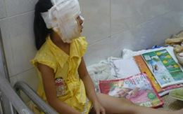 Bố nướng mực, con cháy mặt