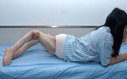 Cô gái có đôi chân cong kì lạ