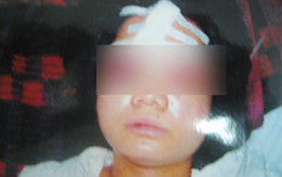 Người phụ nữ bị đánh dập sọ não ở Hưng Yên cũng bị... tuyên án