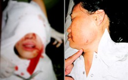 "Tập kích" cả nhà nạn nhân vẫn ngoài vòng pháp luật