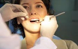 Thời điểm nên đi lấy cao răng