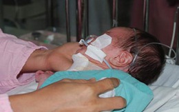 Bé sơ sinh mang khối u to bằng đầu