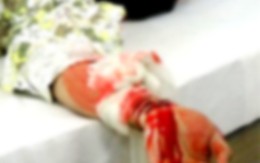 Tự rạch tay rồi bịa chuyện bị cướp