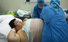Chàng khổng lồ hút mỡ để làm đẹp