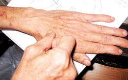 "Cách tự bấm huyệt chữa vô sinh": Kiên nhẫn sẽ thành