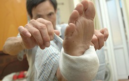 Thực hư bó thuốc vào chân trị tai biến mạch máu não