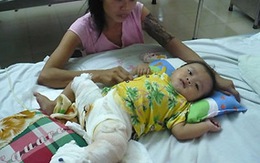 Bé 6 tháng sống sót nhờ vạt da tay của mẹ