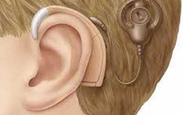 Lần đầu gắn thiết bị chữa điếc cho trẻ khiếm thính