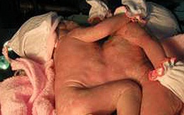 Hai bé gái chung nhau ngực và bụng