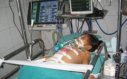 Đi khai giảng, bé 9 tuổi bị xe tông 