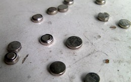 Bé trai ốm nặng vì "giấu" pin vào mũi 