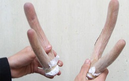 Chết vì chữa bất lực bằng nhung hươu 