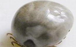 Bọ lạ cắn chết 31 người