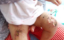 Bé 9 tháng bị mẹ đánh dã man vì mê tín?