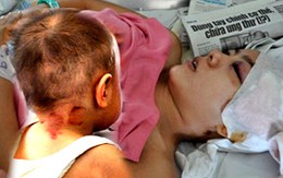 Hãi hùng lời kể nạn nhân vụ cuồng sát bằng búa