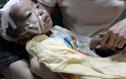 Con đang khỏe mạnh bỗng dưng bệnh trọng